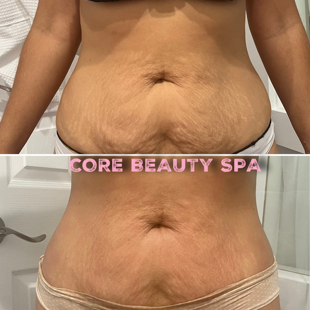 Core Beauty Spa | 927 Willis Ave, Albertson, NY 11507 | Phone: (347) 283-8280