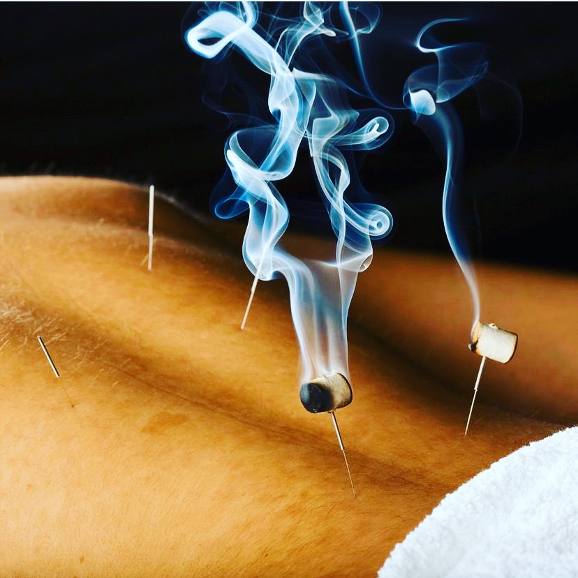 Monarch Acupuncture | 333 Glen Head Rd Suite 70, Glen Head, NY 11545 | Phone: (516) 801-0097