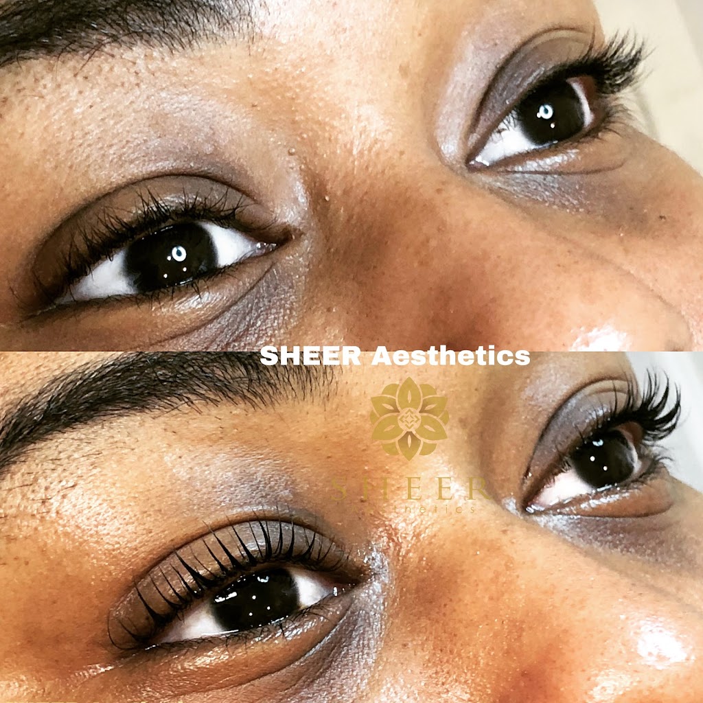 SHEER Aesthetics | 300 Hempstead Turnpike, West Hempstead, NY 11552 | Phone: (516) 226-0532