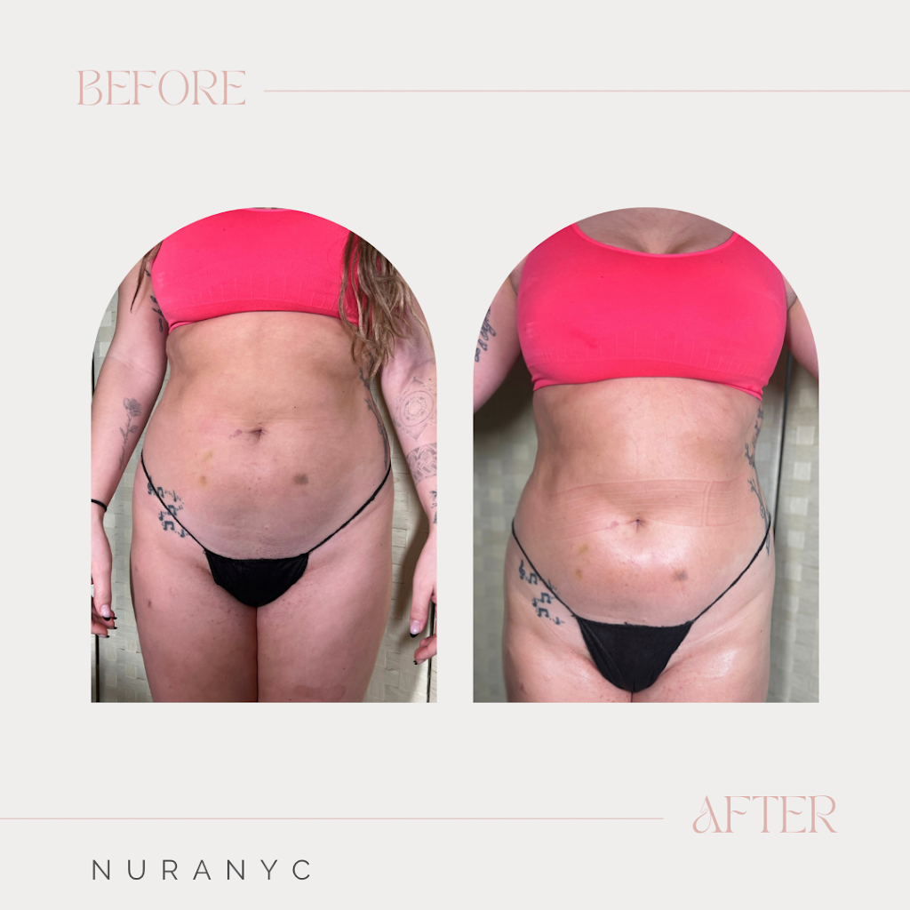 Nura Medispa | 1300 Grand Ave, Baldwin, NY 11510 | Phone: (917) 309-3606