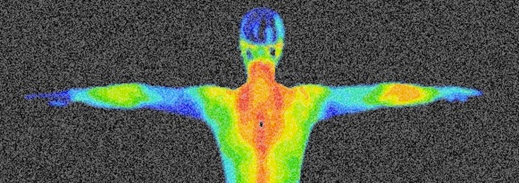 Thermographic Health Advantage | 64 Theodore Roosevelt Dr, Blauvelt, NY 10913 | Phone: (845) 222-6923