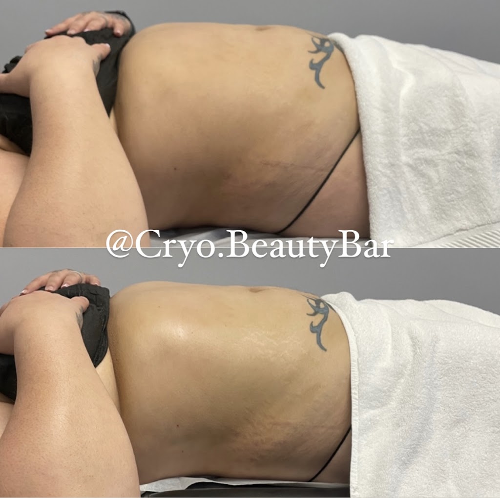 Cryo.BeautyBar | The Rockledge Building, 1600 Harrison Ave Suite 307F, Mamaroneck, NY 10543 | Phone: (914) 902-8996