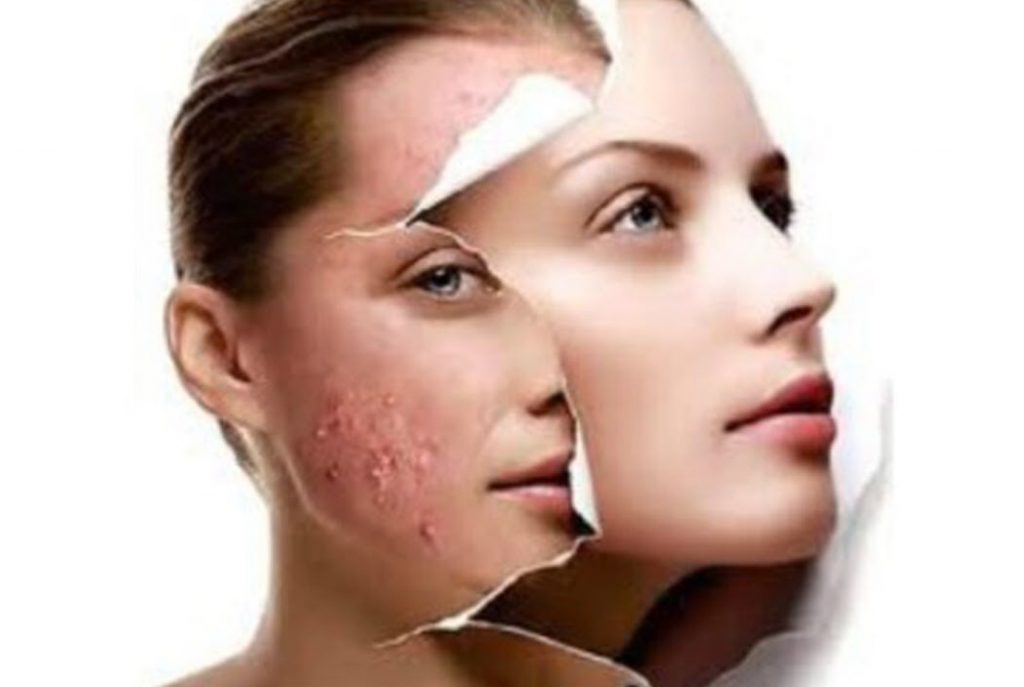 Skinovation Advanced Skincare LLC | 410 Churchill Rd, Teaneck, NJ 07666 | Phone: (201) 446-6774