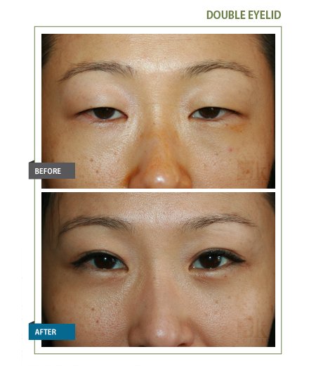 JK Facial Plastics - John Kang, MD | 219-02 Northern Blvd #2fl, Bayside, NY 11361 | Phone: (718) 229-6050