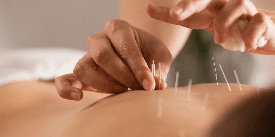 Acupuncture in New York @ Nyhealers | 41 River Terrace, New York, NY 10282 | Phone: (646) 400-8339