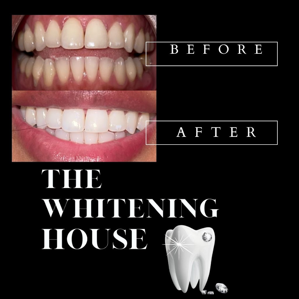 The Whitening House | 473 River Rd Suite 130, Edgewater, NJ 07020 | Phone: (201) 204-0551