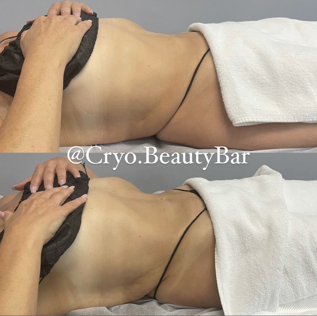 Cryo.BeautyBar | The Rockledge Building, 1600 Harrison Ave Suite 307F, Mamaroneck, NY 10543 | Phone: (914) 902-8996