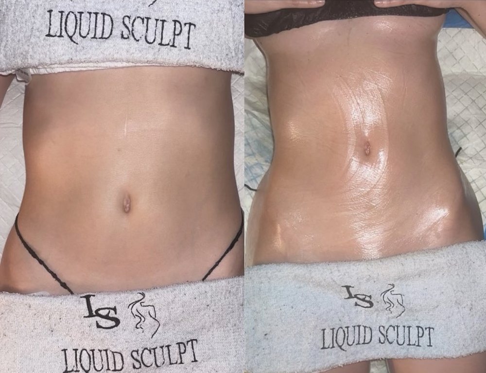 Liquid Sculpt | 2-8, Haven Ave, Port Washington, NY 11050 | Phone: (516) 388-8484