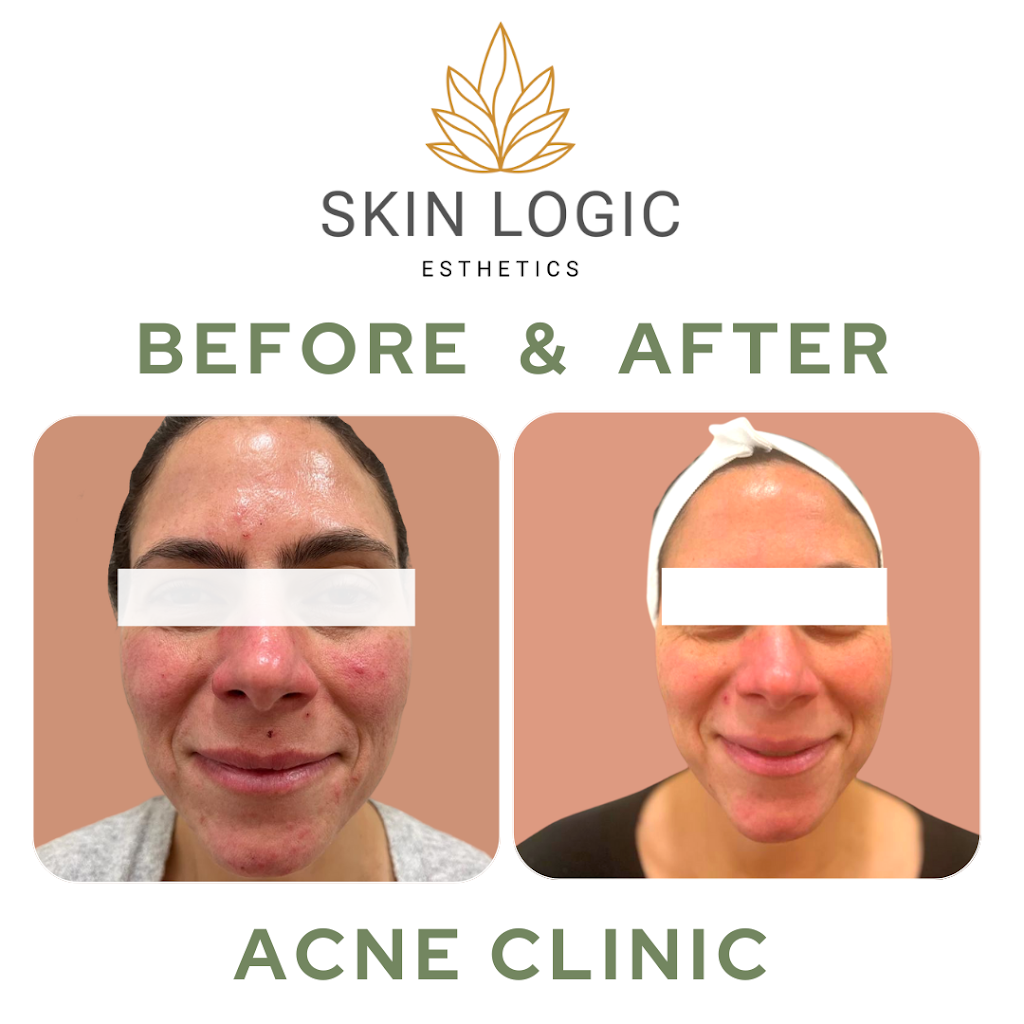 Skin Logic Esthetics | 443 Tarrytown Rd Suite 129, White Plains, NY 10607 | Phone: (914) 806-2186