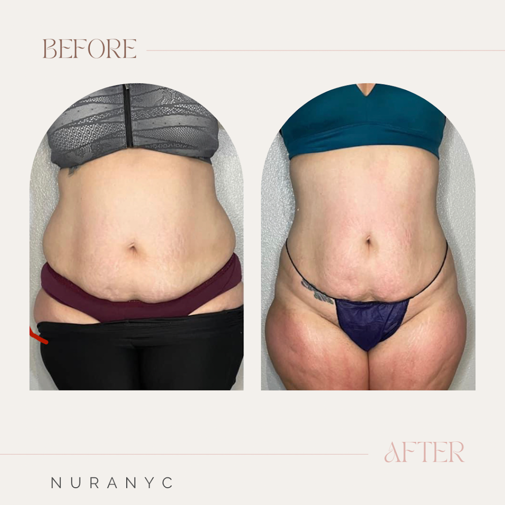 Nura Medispa | 1300 Grand Ave, Baldwin, NY 11510 | Phone: (917) 309-3606