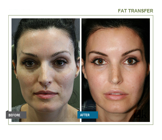 JK Facial Plastics - John Kang, MD | 219-02 Northern Blvd #2fl, Bayside, NY 11361 | Phone: (718) 229-6050