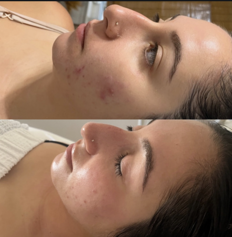 Skin By Ariana | 90 Nardozzi Pl Suite 207, New Rochelle, NY 10805 | Phone: (914) 712-8382